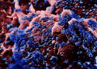  " " H5N1
