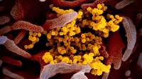Ученые обнаружили у клеток, зараженных коронавирусом, «зловещие щупальца»