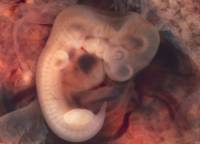 В Австралии вырастили модель эмбриона человека из клеток кожи